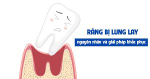 Răng bị lung lay - nguyên nhân và giải pháp khắc phục
