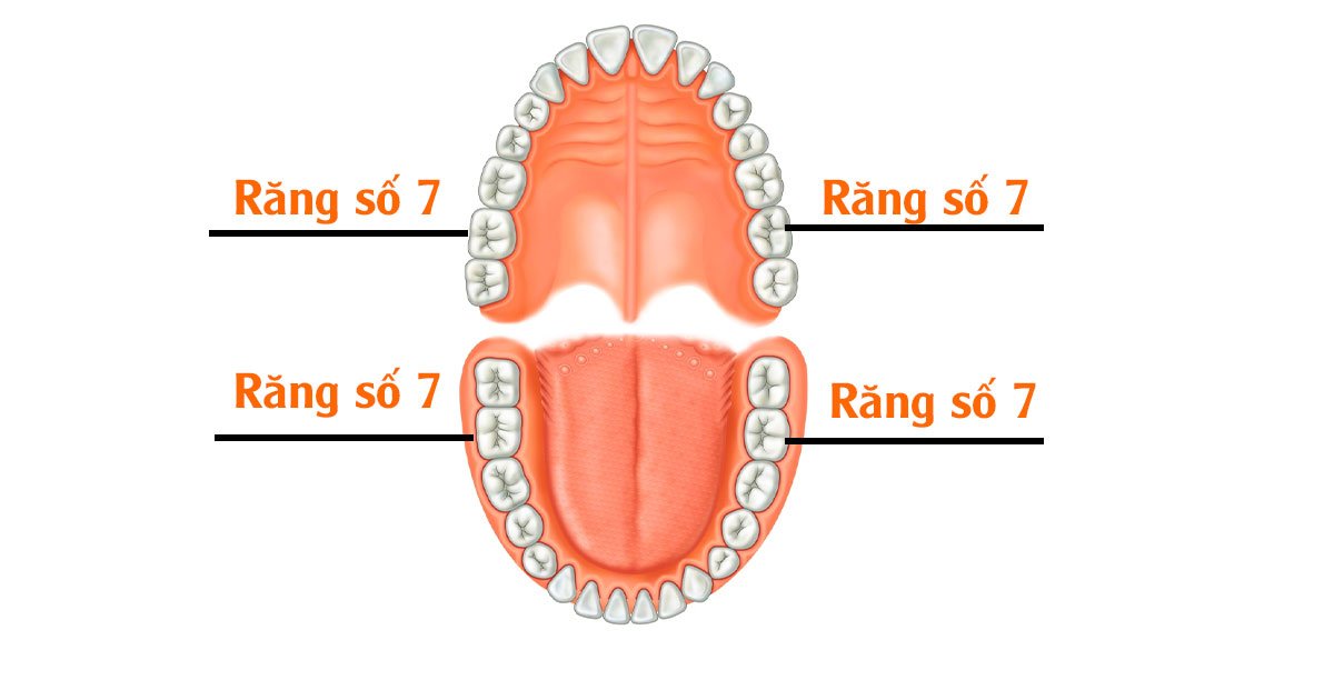 Vị trí răng số 7 trên cung hàm