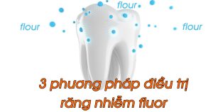 3 phương pháp điều trị răng nhiễm fluor