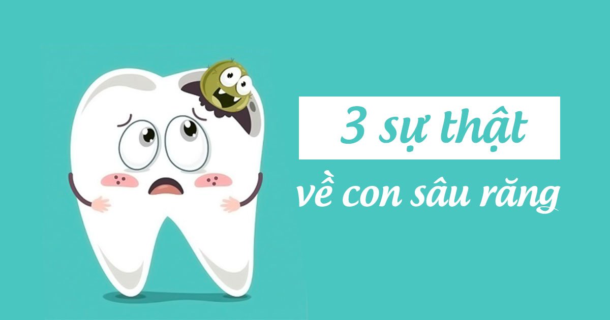 3 sự thật về con sâu răng