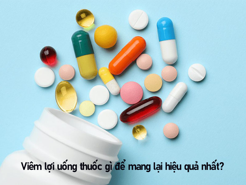 Viêm lợi uống thuốc gì để mang lại hiệu quả nhất?