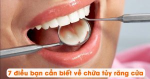 7 điều bạn cần biết về chữa tủy răng cửa