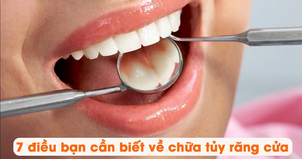 7 điều bạn cần biết về chữa tủy răng cửa