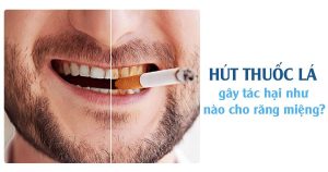 Hút thuốc lá gây tác hại như nào cho răng miệng?