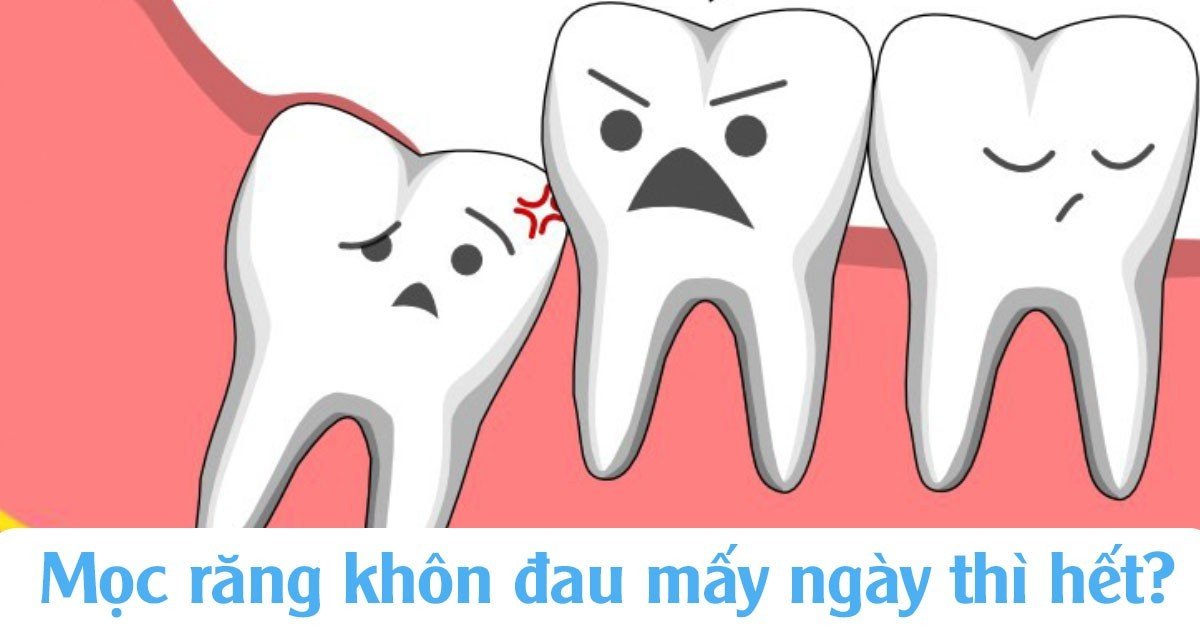 Mọc răng khôn đau mấy ngày thì hết?
