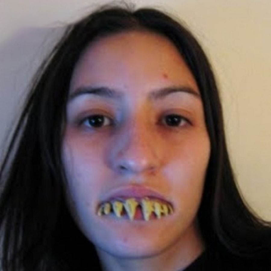 Cô gái sở hữu hàm răng nhọn kinh dị