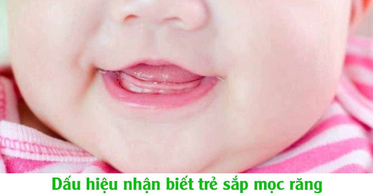 Dấu hiệu nhận biết trẻ sắp mọc răng