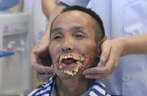Người đàn ông có hàm răng xấu nhất thể giới