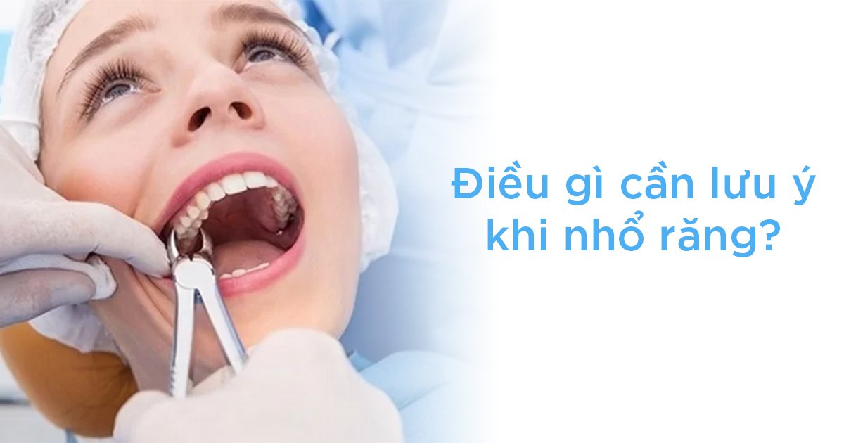 Điều gì cần lưu ý gì khi nhổ răng?