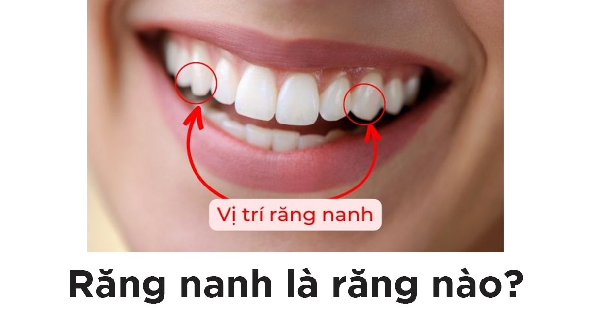 Răng nanh là răng nào?