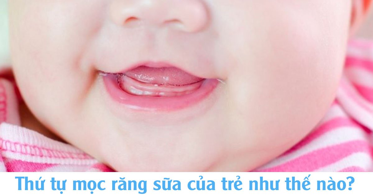 Thứ tự mọc răng sữa của trẻ như thế nào?