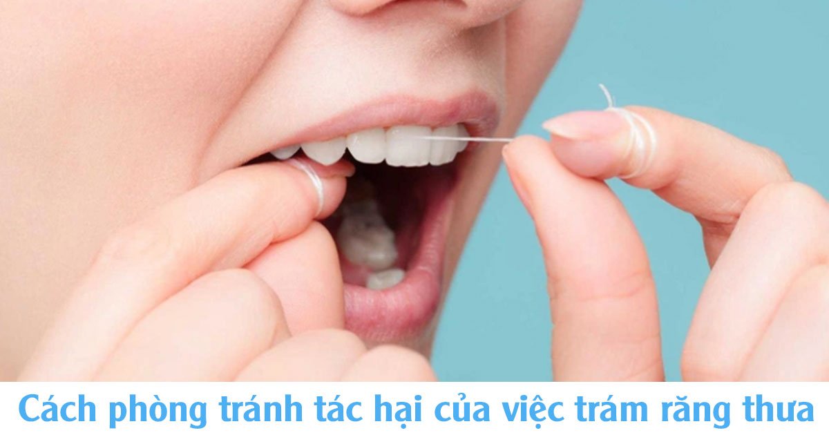 Cách phòng tránh tác hại của việc trám răng thưa