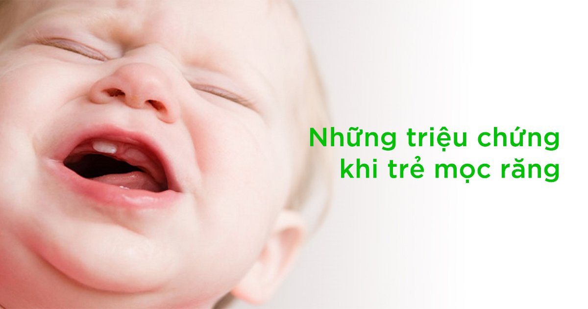 Những triệu chứng khi trẻ mọc răng