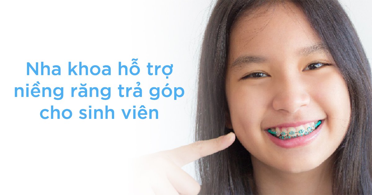 Nha khoa hỗ trợ niềng răng trả góp cho sinh viên