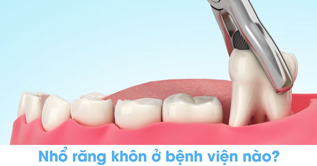 Nhổ răng khôn ở bệnh viện nào?