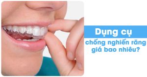 Dụng cụ chống nghiến răng giá bao nhiêu?