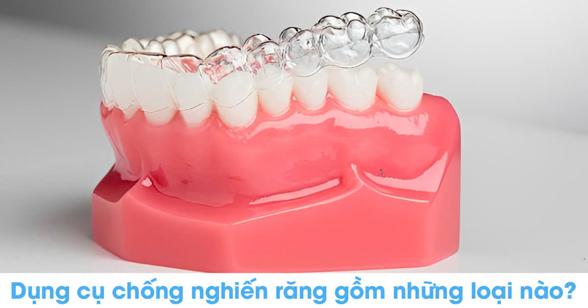 Dụng cụ chống nghiến răng gồm những loại nào?