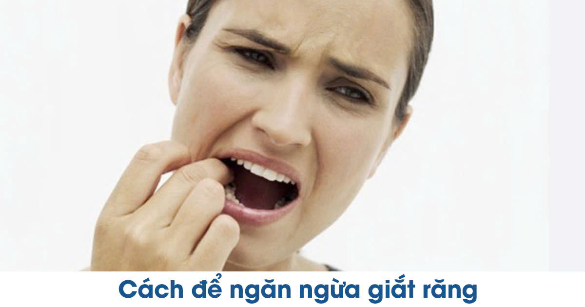 Cách để ngăn ngừa giắt răng