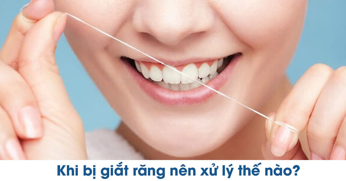 Khi bị giắt răng nên xử lý thế nào?