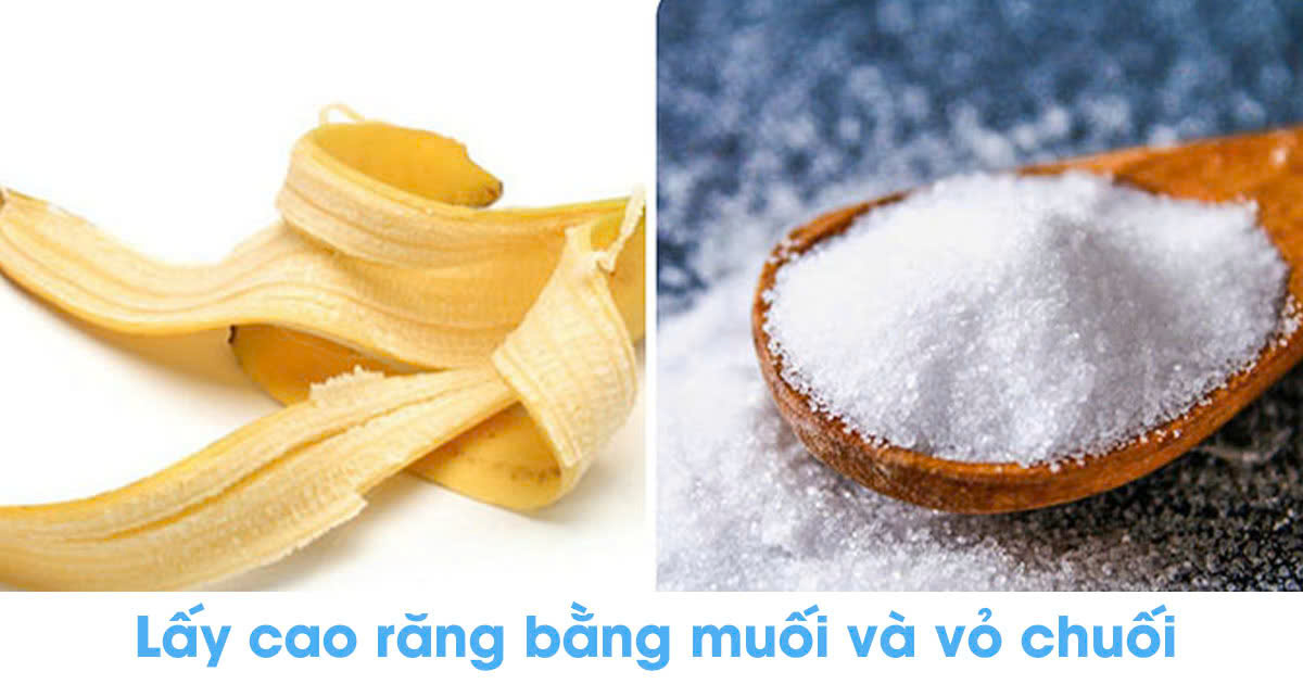 Lấy cao răng bằng muối và vỏ chuối