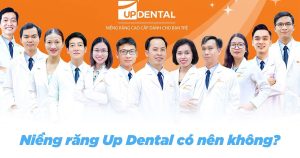 Niềng răng up dental có nên không?