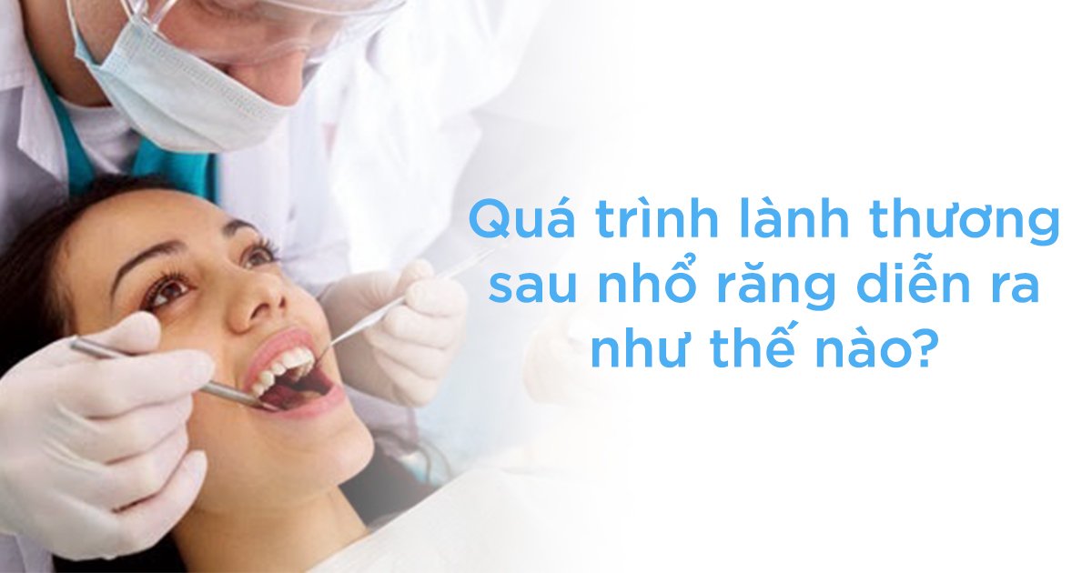 Quá trình lành thương sau nhổ răng diễn ra như thế nào?